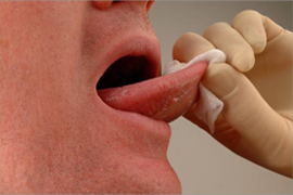 Mouth Cancer Fomdation